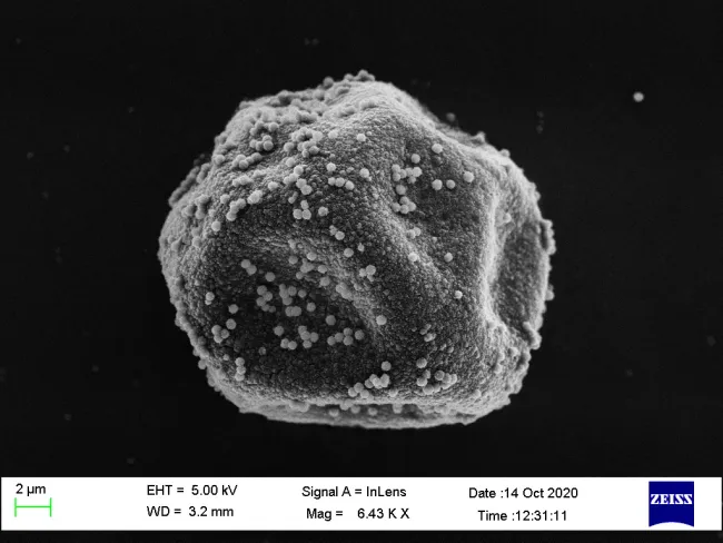 Cypress Pollen SEM Image Cypress Pollen SEM Image
