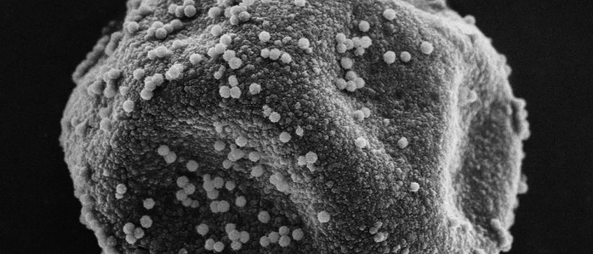 Pollen